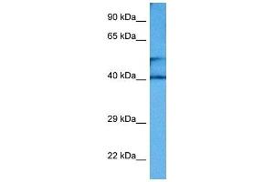 Host:  Rabbit  Target Name:  CKM  Sample Tissue:  Mouse Small Intestine  Antibody Dilution:  1ug/ml (CKM Antikörper  (Middle Region))