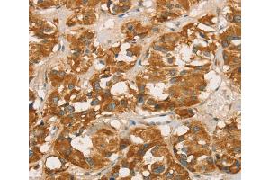 Immunohistochemistry (IHC) image for anti-Retinoblastoma Binding Protein 8 (RBBP8) antibody (ABIN2423210) (Retinoblastoma Binding Protein 8 Antikörper)