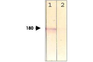The cell lysate derived from conditioned NIH/3T3 was immunoprobed by LRP6 (phospho T1479) polyclonal antibody  at 1 : 500. (LRP6 Antikörper  (pThr1479))
