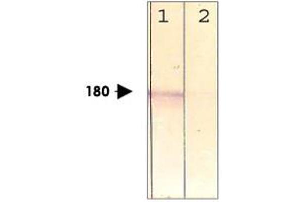 LRP6 抗体  (pThr1479)