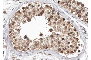 ABIN6268782 at 1/100 staining human testis tissue sections by IHC-P. (PKM Antikörper  (Internal Region))