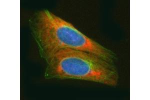IF analysis of RARS/RARS1 using anti-RARS/RARS1 antibody (ABIN7600223) and anti-Tubulin Alpha antibody (ABIN7600339). (Probable Arginine--tRNA Ligase, Cytoplasmic (RARS-1) (AA 165-425) Antikörper)