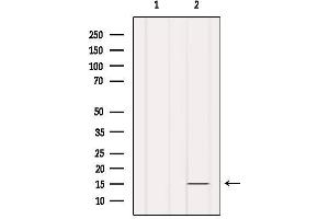 Western blot analysis of extracts from Hela, using INSL5 Antibody. (INSL5 Antikörper)