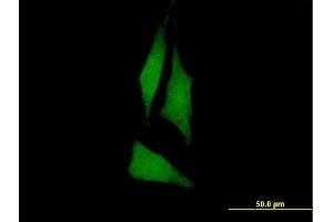 Immunofluorescence of purified MaxPab antibody to PTK6 on HeLa cell. (PTK6 Antikörper  (AA 1-451))