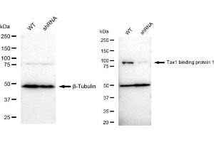 Western blotting analysis using Tax1 binding protein 1 antibody (ABIN7800519).