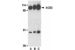 Western blot analysis of ACE2 in human kidney lysate with AP30007PU-N ACE2 antibody at 0. (ACE2 Antikörper  (C-Term))