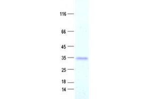 Western Blotting (WB) image for Dickkopf Homolog 1 (DKK1) protein (DYKDDDDK Tag) (ABIN2719478)
