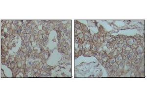 Immunohistochemistry (IHC) image for anti-CD44 (CD44) antibody (ABIN969026)