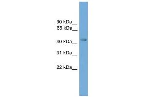 WB Suggested Anti-ERCC8 Antibody Titration: 0. (ERCC8 Antikörper  (Middle Region))