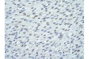 Rabbit Anti-FUSIP1 antibody   Paraffin Embedded Tissue: Human Heart cell Cellular Data: cardiac cell of renal tubule Antibody Concentration: 4.
