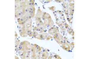 Immunohistochemistry of paraffin-embedded human stomach using CETN3 antibody.