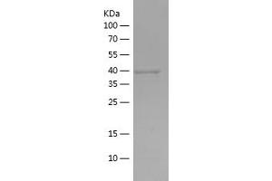 Western Blotting (WB) image for Actin, Alpha, Cardiac Muscle 1 (ACTC1) (AA 236-368) protein (His-IF2DI Tag) (ABIN7282016) (ACTC1 Protein (AA 236-368) (His-IF2DI Tag))