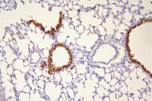 IHC analysis of Hsp20 using anti-Hsp20 antibody (ABIN5518920).