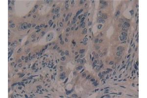 Immunohistochemistry (IHC) image for anti-Ribosomal Protein S6 Kinase, 90kDa, Polypeptide 1 (RPS6KA1) (AA 62-321) antibody (ABIN7441682)