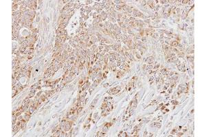 Immunohistochemistry (IHC) image for anti-Leucine Zipper-EF-Hand Containing Transmembrane Protein 1 (LETM1) (C-Term) antibody (ABIN2856867)