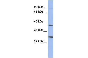 WB Suggested Anti-MAGEB2 Antibody Titration: 0. (MAGEB2 Antikörper  (N-Term))
