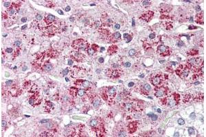 Adrenal, Human: Formalin-Fixed, Paraffin-Embedded (FFPE) (NTSR2 Antikörper  (Internal Region))