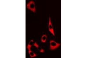 Immunofluorescent analysis of MRP8 staining in MCF7 cells. (S100A8 Antikörper)