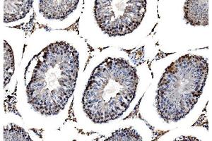 IHC analysis of RRS1 using anti-RRS1 antibody (ABIN7601344). (RRS1 Antikörper  (AA 33-266))