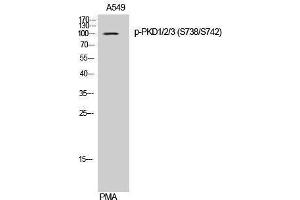Western Blotting (WB) image for anti-Polycystic Kidney Disease 1/2/3 (PKD1/2/3) (pSer738), (pSer742) antibody (ABIN3182590) (PKD1/2/3 Antikörper  (pSer738, pSer742))
