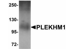 Image no. 1 for anti-Pleckstrin Homology Domain Containing, Family M (With RUN Domain) Member 1 (PLEKHM1) (N-Term) antibody (ABIN478196) (PLEKHM1 Antikörper  (N-Term))