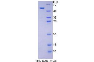 SDS-PAGE analysis of Mouse Estrogen Receptor 2 Protein.