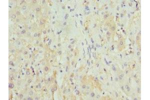 Immunohistochemistry of paraffin-embedded human liver tissue using ABIN7155891 at dilution of 1:100 (HGD Antikörper  (AA 226-445))