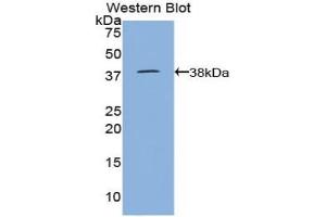 Detection of Recombinant LTF, Goat using Polyclonal Antibody to Lactoferrin (LTF) (Lactoferrin Antikörper  (AA 25-352))