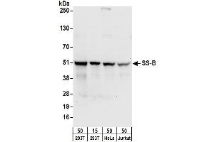 Western Blotting (WB) image for anti-Sjogren Syndrome Antigen B (SSB) (AA 358-408) antibody (ABIN7453946)