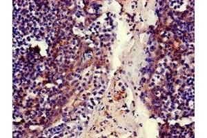 Immunohistochemistry of paraffin-embedded human tonsil tissue using ABIN7159312 at dilution of 1:100 (MFI2 Antikörper  (AA 20-302))