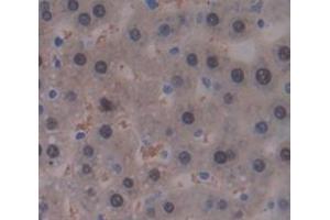 IHC-P analysis of Rat Tissue, with DAB staining. (GALT Antikörper  (AA 1-379))