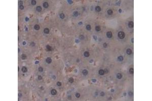 IHC-P analysis of Rat Tissue, with DAB staining. (GALT Antikörper  (AA 1-379))