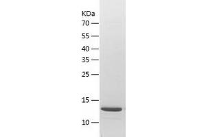 Western Blotting (WB) image for Immunoglobulin Superfamily, Member 6 (IGSF6) (AA 28-153) protein (His tag) (ABIN7123411) (IGSF6 Protein (AA 28-153) (His tag))