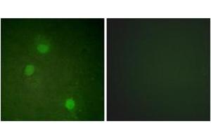 Immunofluorescence analysis of HeLa cells, using AurB (Ab-232) Antibody. (Aurora Kinase B Antikörper  (AA 198-247))