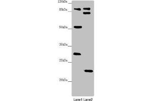 Western blot All lanes: KANSL3 antibody at 1. (KANSL3 Antikörper  (AA 1-200))