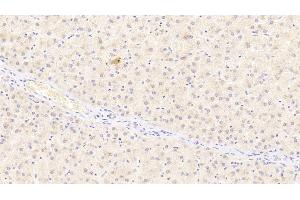 Detection of ADIPOR2 in Human Liver Tissue using Polyclonal Antibody to Adiponectin Receptor 2 (ADIPOR2) (Adiponectin Receptor 2 Antikörper  (AA 2-155))