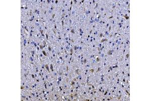IHC analysis of EEF2/Elongation factor 2 using anti-EEF2/Elongation factor 2 antibody (ABIN7603142).