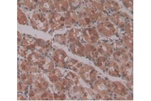 DAB staining on IHC-P Samples:Human Stomach Tissue. (ENPP2 Antikörper  (AA 637-905))