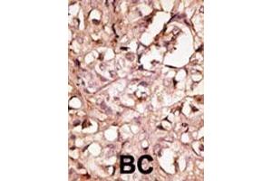 Immunohistochemistry (Paraffin-embedded Sections) (IHC (p)) image for anti-Lymphatic Vessel Endothelial Hyaluronan Receptor 1 (LYVE1) (AA 46-77), (N-Term) antibody (ABIN388751)