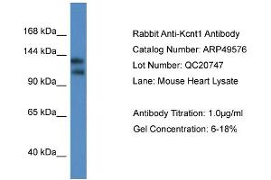 Western Blotting (WB) image for anti-Potassium Channel, Subfamily T, Member 1 (KCNT1) (C-Term) antibody (ABIN2783808)