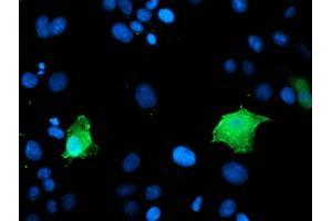 Image no. 1 for anti-Low Density Lipoprotein Receptor Adaptor Protein 1 (LDLRAP1) antibody (ABIN1496688) (LDLRAP1 Antikörper)