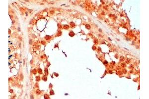 ABIN2560635 (2µg/ml) staining of paraffin embedded Human Testis. (UBE2R2 Antikörper  (N-Term))