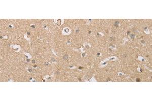 Immunohistochemistry of paraffin-embedded Human brain tissue using P2RY11 Polyclonal Antibody at dilution of 1:30(x200) (P2RY11 Antikörper)