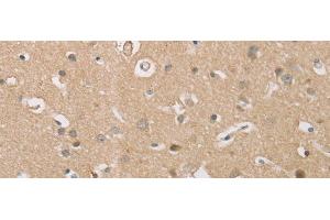 Immunohistochemistry of paraffin-embedded Human brain tissue using P2RY11 Polyclonal Antibody at dilution of 1:30(x200)