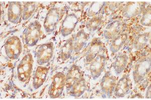 Immunohistochemistry of paraffin-embedded Rat colon using HRAS Polycloanl Antibody at dilution of 1:200 (HRAS Antikörper)