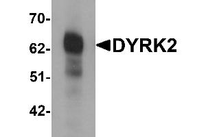 Western blot analysis of DYRK2 in 293 cell lysate with DYRK2 antibody at (A) 1 and (B) 2 µg/mL. (DYRK2 Antikörper  (C-Term))