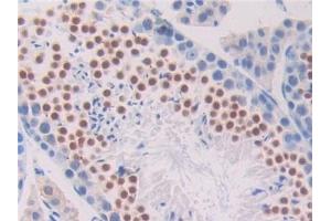 Detection of PNOC in Mouse Testis Tissue using Polyclonal Antibody to Pronociceptin (PNOC) (Pronociceptin (AA 12-187) Antikörper)
