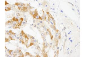 anti-Tripartite Motif Containing 3 (TRIM3) (AA 1-50) antibody