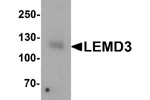 Western blot analysis of LEMD3 in human colon tissue lysate with LEMD3 antibody at 1 µg/mL. (LEMD3 Antikörper  (C-Term))