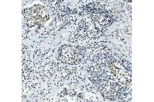 IHC analysis of PRDM5 using anti-PRDM5 antibody (ABIN7600853). (PRDM5 Antikörper  (AA 24-630))